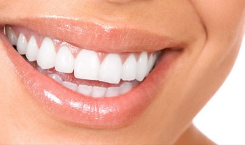Igienista dentale cosa fa - Studio dentistico Motta Jones Rossi & Associati
