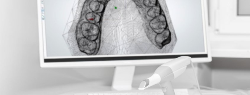 impronta dentale digitale