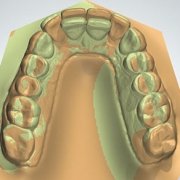 ortodonzia digitale studio dentistico motta rossi milano centro