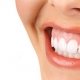 Gummy smile - Studio dentistico associato Motta Jones Rossi - Milano centro