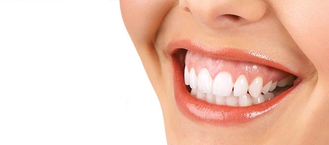 Gummy smile - Studio dentistico associato Motta Jones Rossi - Milano centro