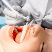 Studio Motta Jones - Rossi - Associati - pulizia dei denti e detartrasi