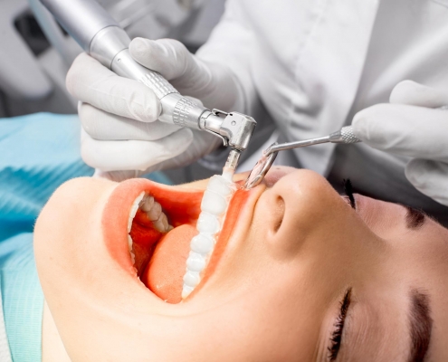 Studio Motta Jones - Rossi - Associati - pulizia dei denti e detartrasi