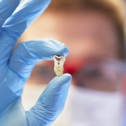 alveolite post estrattiva