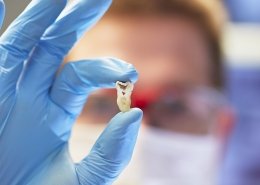 alveolite post estrattiva