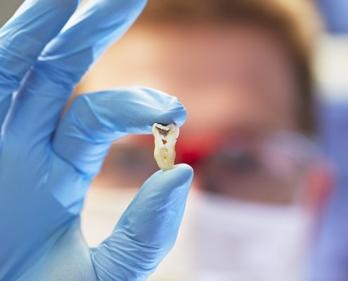 alveolite post estrattiva