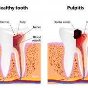 Pulpite - Studio Dentistico Motta Jones, Rossi & Associati