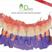 Dalla diagnosi alla protesi - Studio Motta Rossi