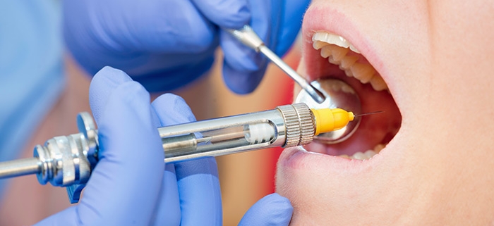 anestesia dal dentista - Studio Motta Jones, Rossi & Associati