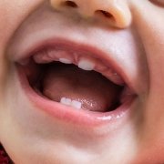 dentizione nei neonati - Studio Motta Jones, Rossi & Associati