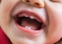 dentizione nei neonati - Studio Motta Jones, Rossi & Associati