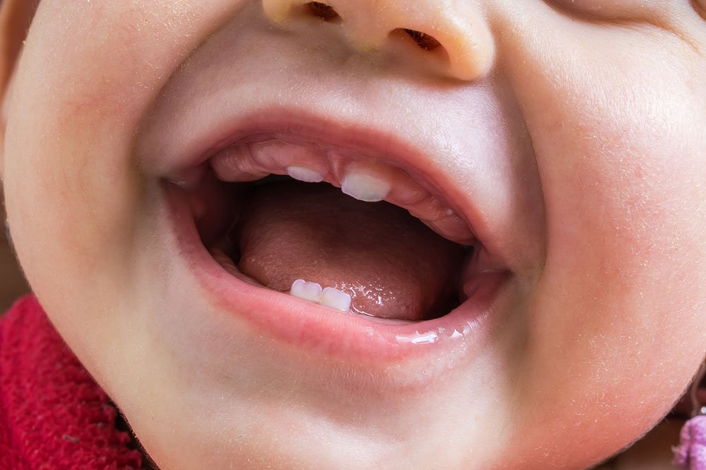 Quando avviene la dentizione nei neonati? Riconoscere i sintomi