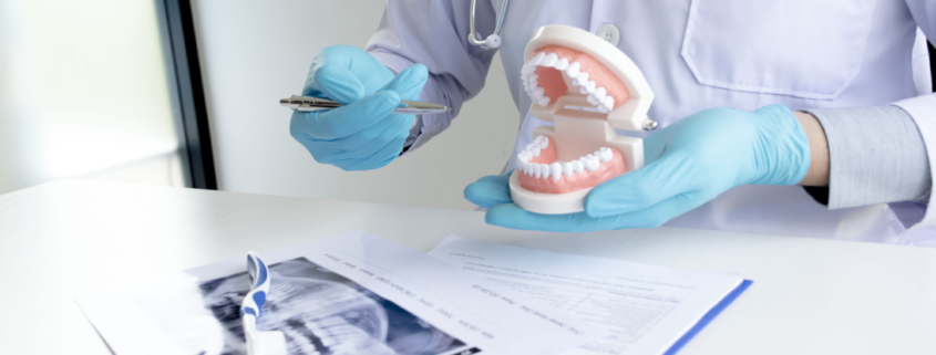 Autotrapianto dentale, quando è efficace?