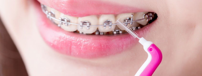 scovolino-denti-02