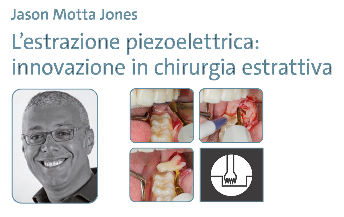estrazione-piezoelettrica-corso