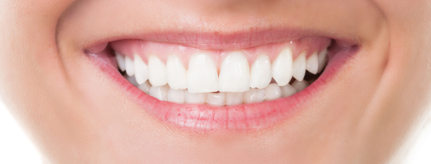 denti-consumati-1